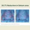Calming Moisture Serum