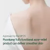 Calming Acne Clear Body Wash